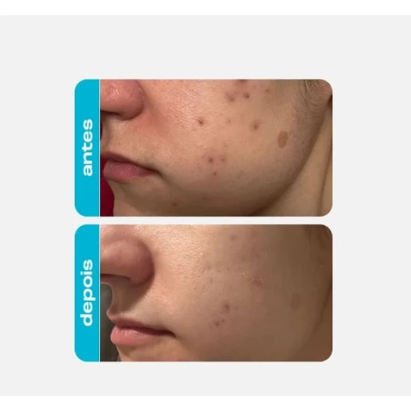 CREAMY - ÁCIDO GLICÓLICO 30g