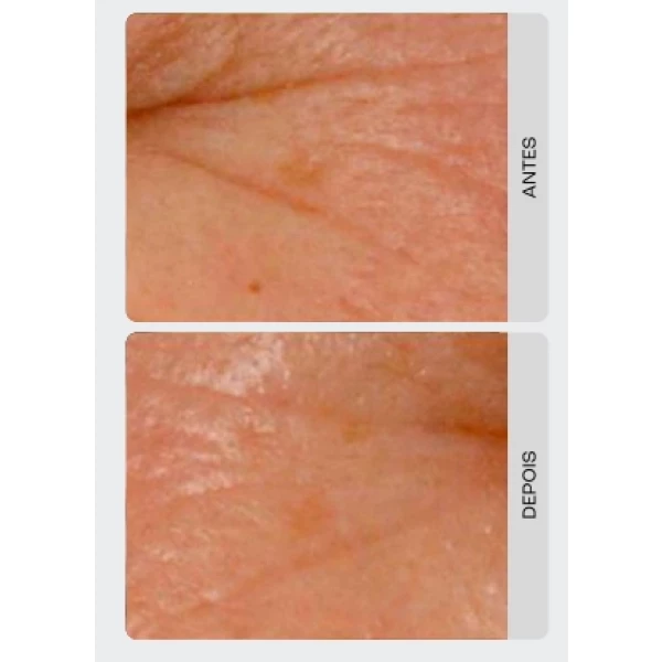 CREAMY - GEL CREME RETINOL 0,3 30g