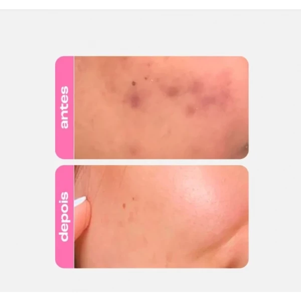 CREAMY - NIACINAMIDE B COMPLEX 20% 30ml