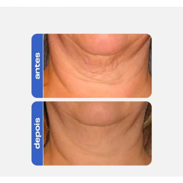 CREAMY - PEPTIDE CREAM ANTI-AGING FIRMADOR 30g