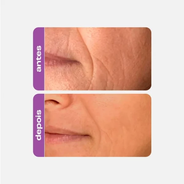 CREAMY - REFIL RETINOL 30g